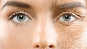 مقایسه بین چین و چروک های پوست انسان که یکیش پیر شده و اون یکی جوان مونده به دلیل استفاده از محصولات مراقبت پوستی